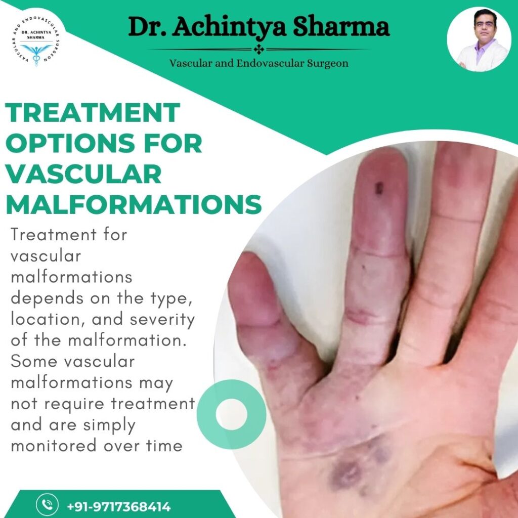  vascular malformation