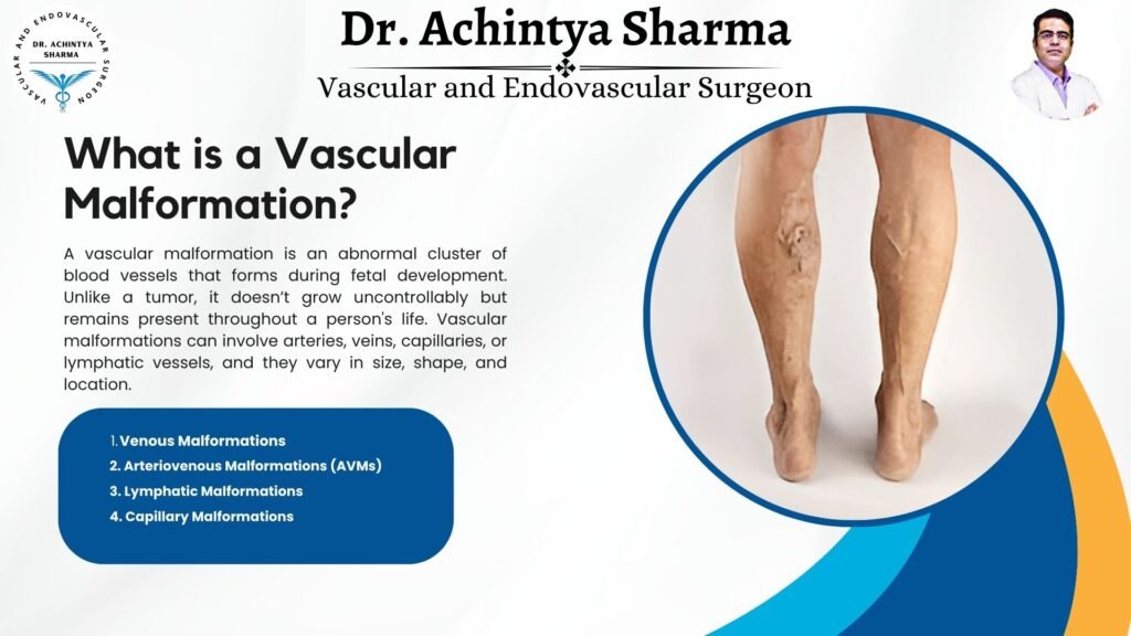 Vascular malformations