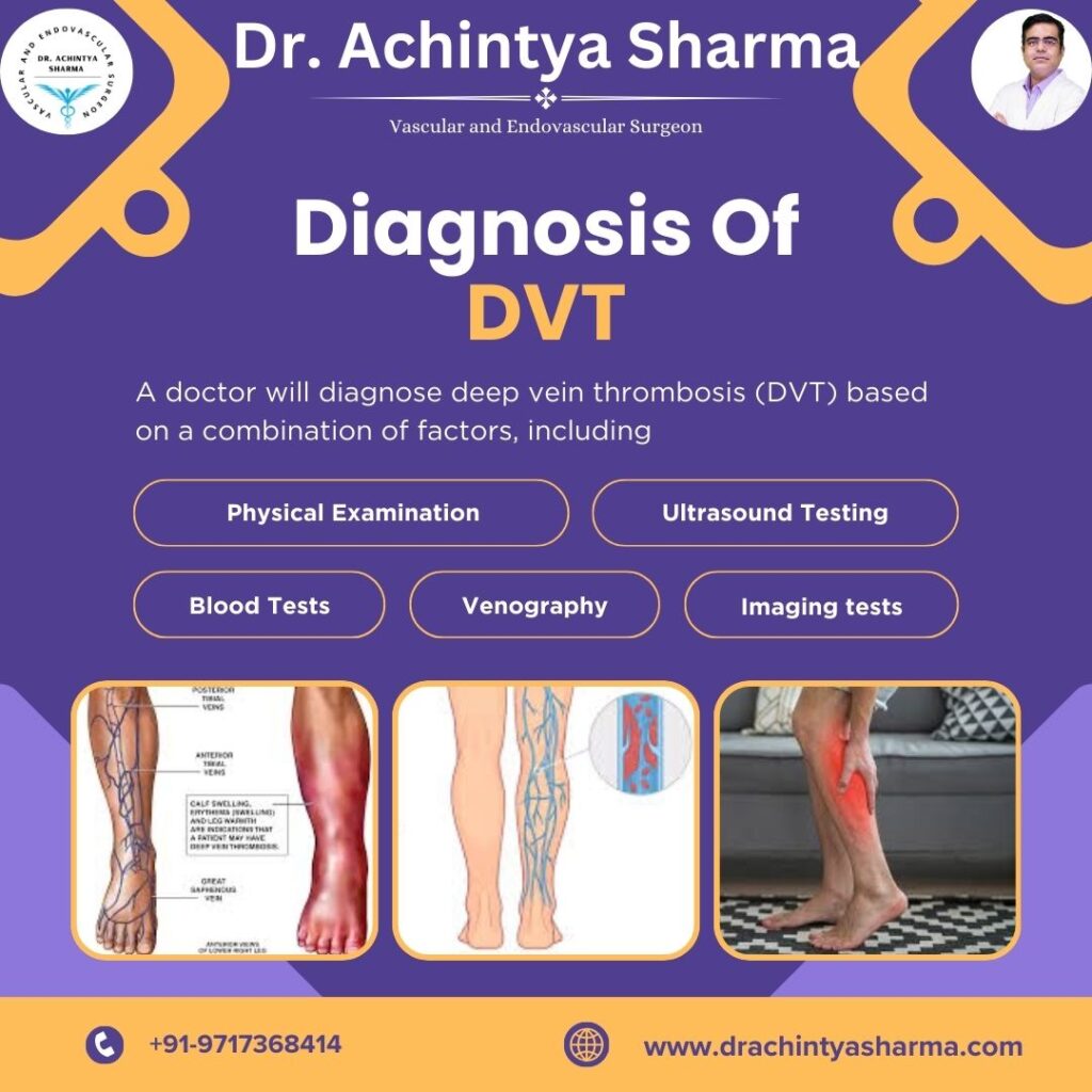 DVT Symptoms