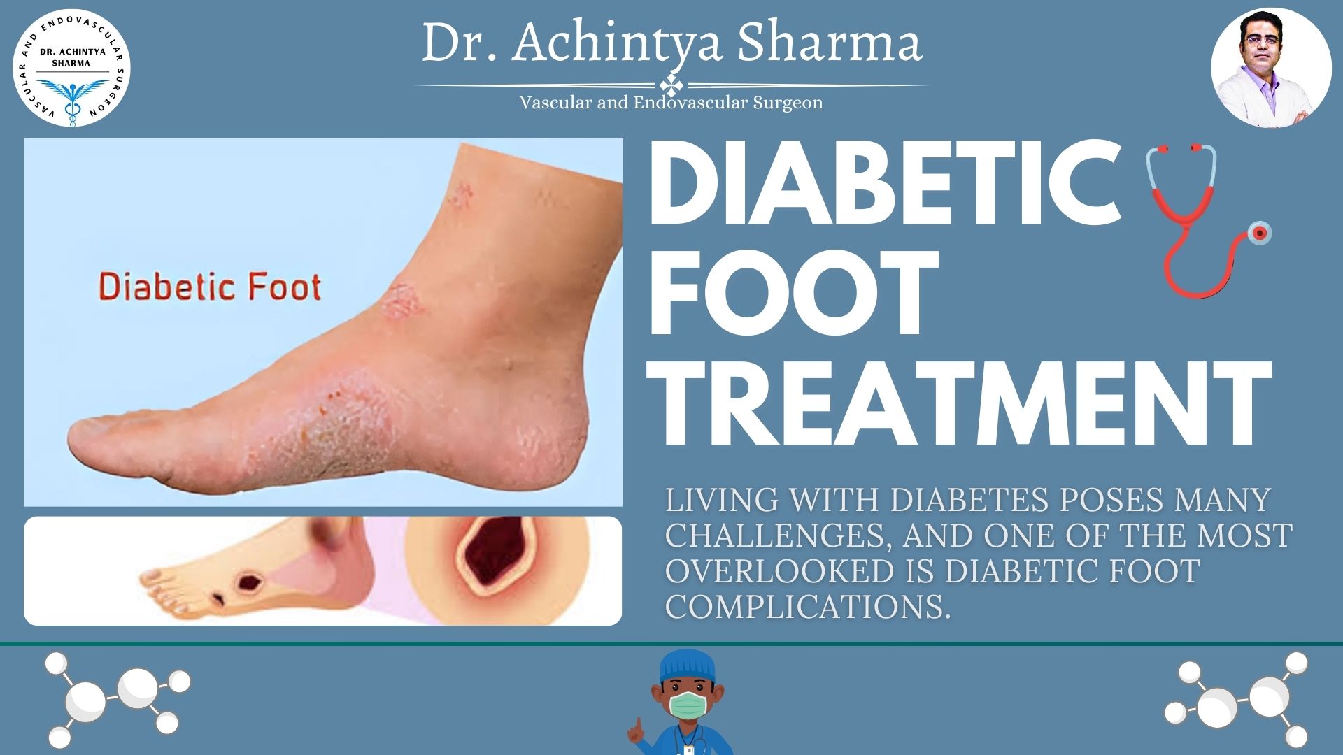 Diabetic Foot Treatment: Heal Faster, Live Betterd