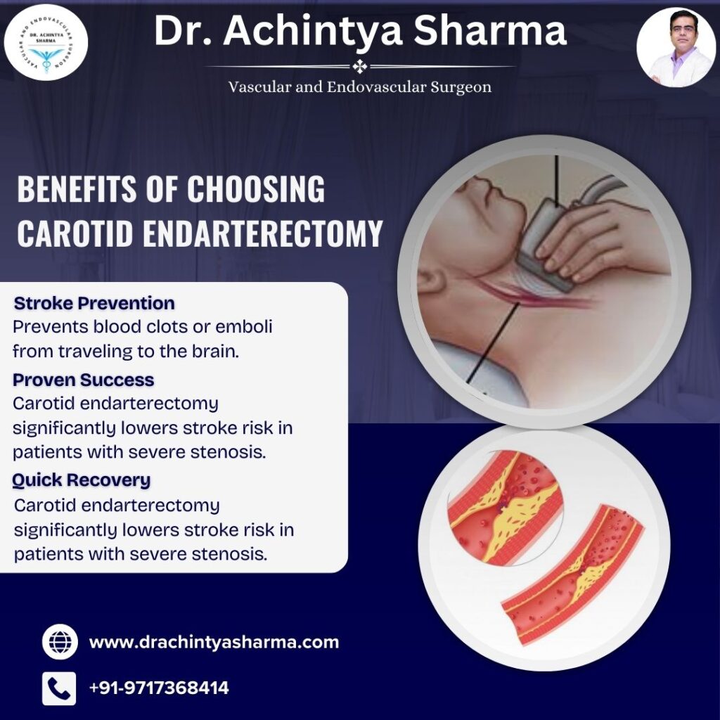 Carotid Endarterectomy