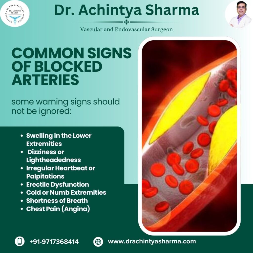 signs of blocked arteries