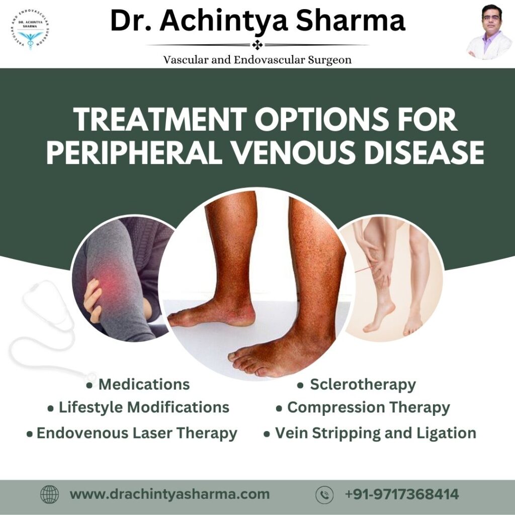 
Peripheral Venous Disease