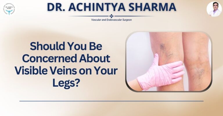 Should You Be Concerned About Visible Veins on Your Legs?