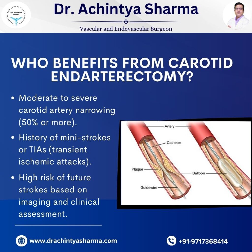  Carotid Endarterectomy