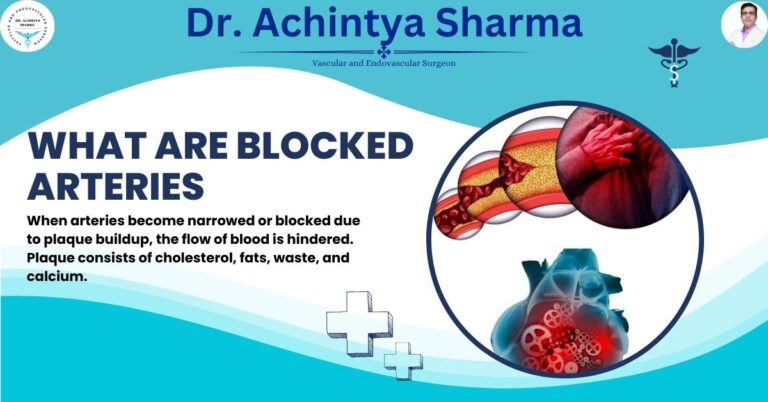 Signs of Blocked Arteries: What You Need to Know