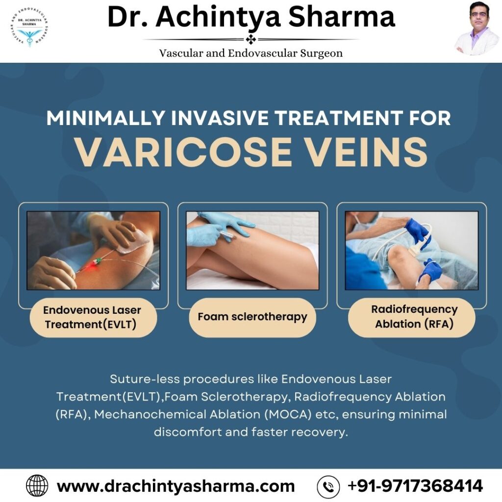 varicose doctor near me