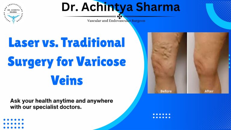 Laser vs. Traditional Surgery for Varicose Veins: Pros and Cons