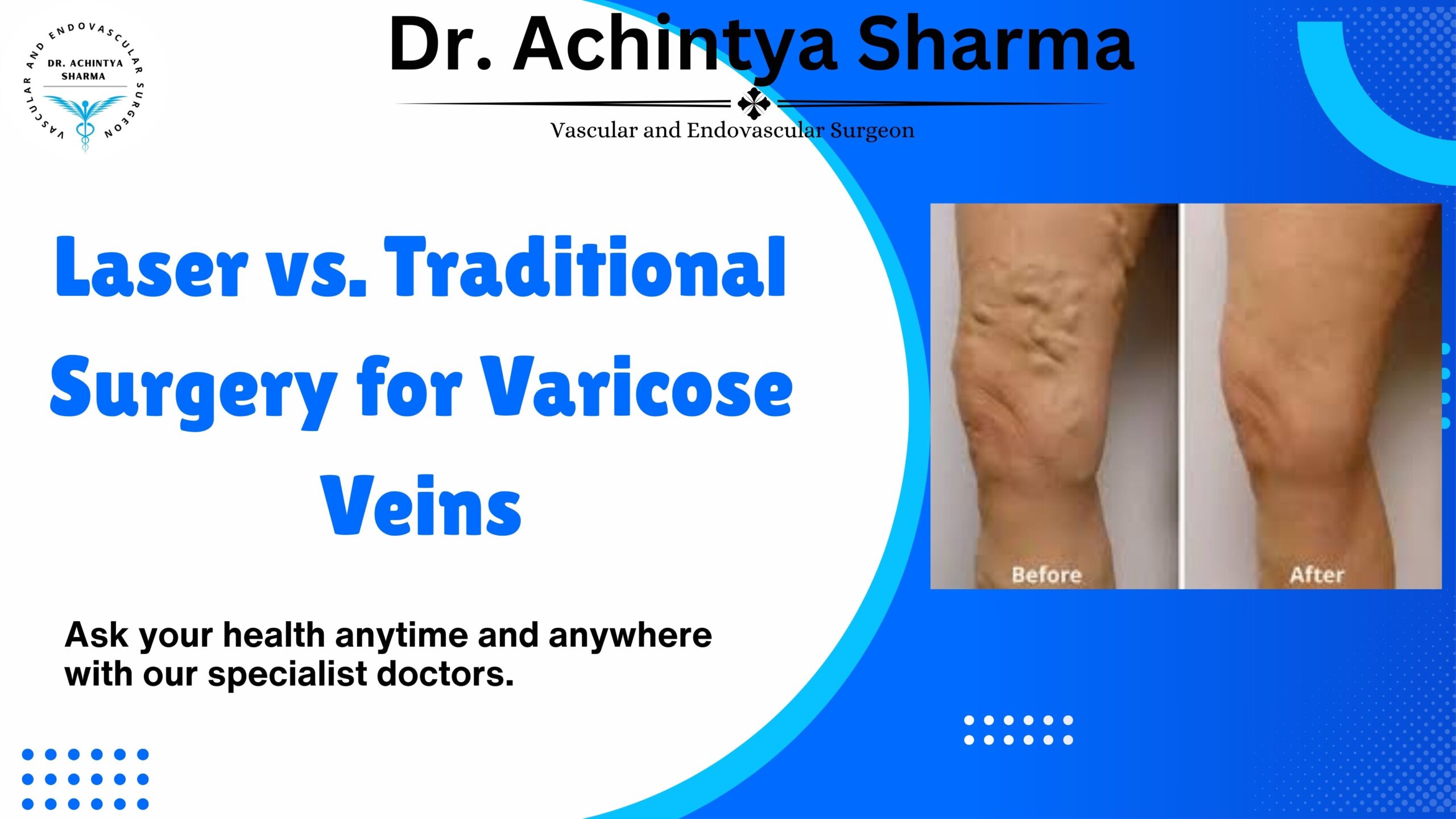 Laser vs. Traditional Surgery for Varicose Veins: Pros and Cons