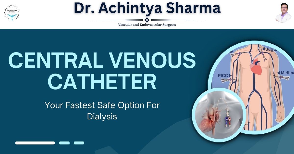 Need Dialysis Urgently? Why a Central Venous Catheter Is Your Fastest Safe Option