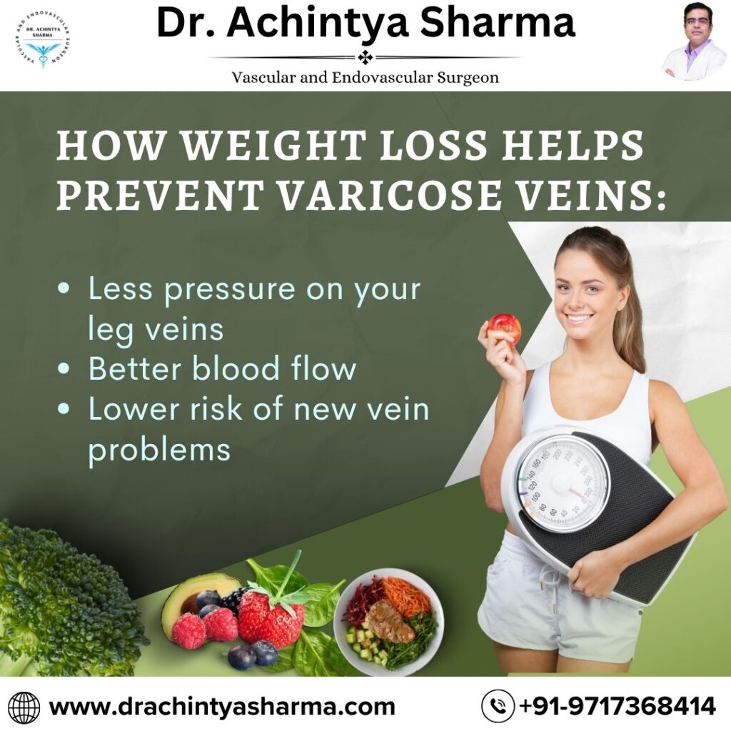 Varicose Veins Pain Relief