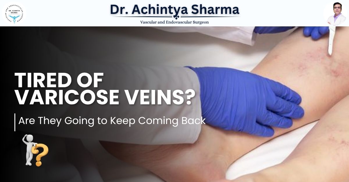 Tired of Varicose Veins? Are They Going to Keep Coming Back?