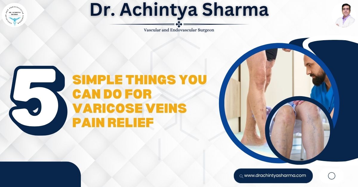 5 Simple Things You Can Do for Varicose Veins Pain Relief