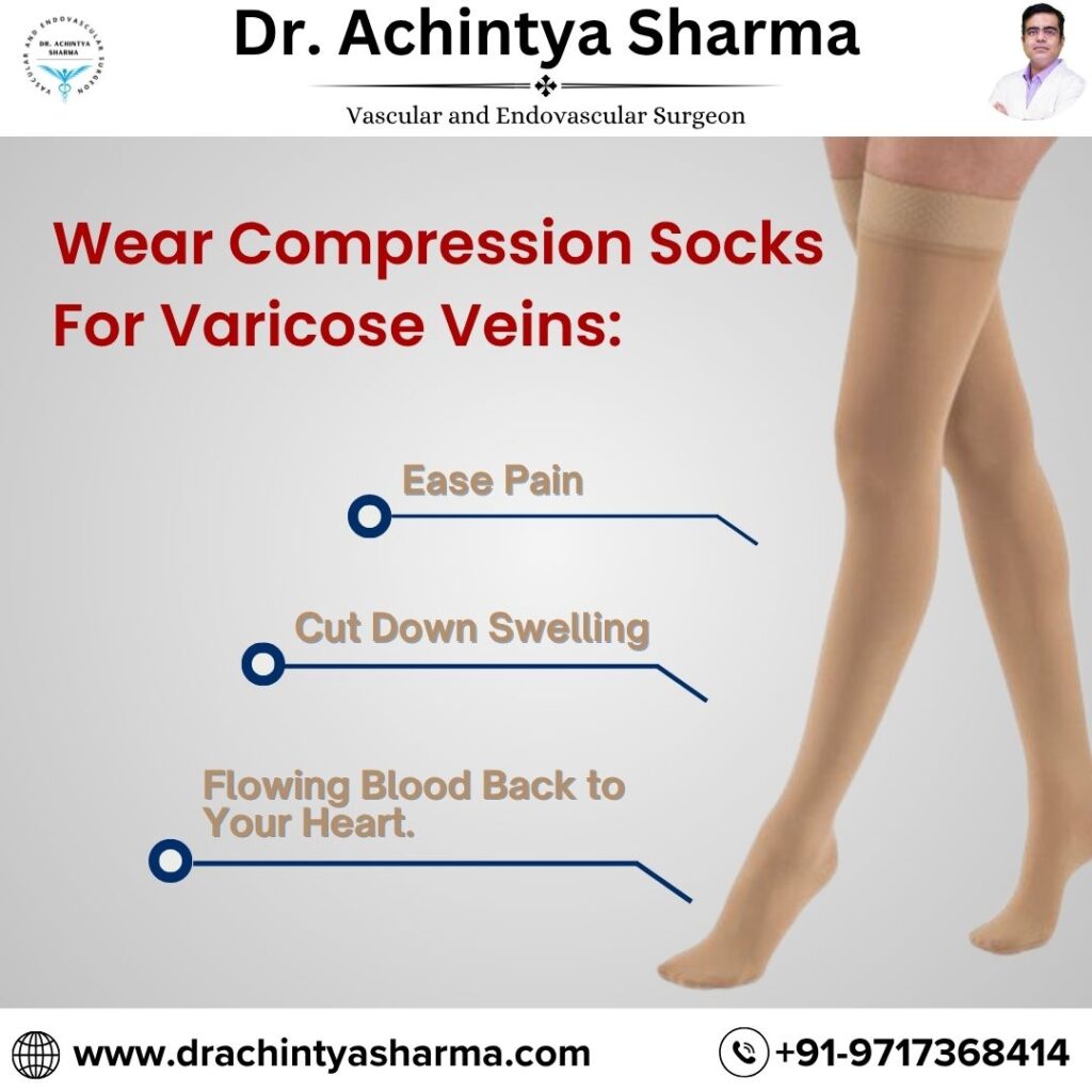 Varicose Veins Pain Relief