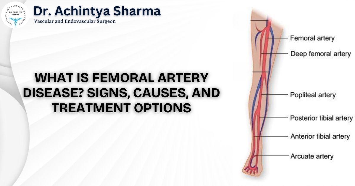What Is Femoral Artery Disease? Signs, Causes, and Treatment Options