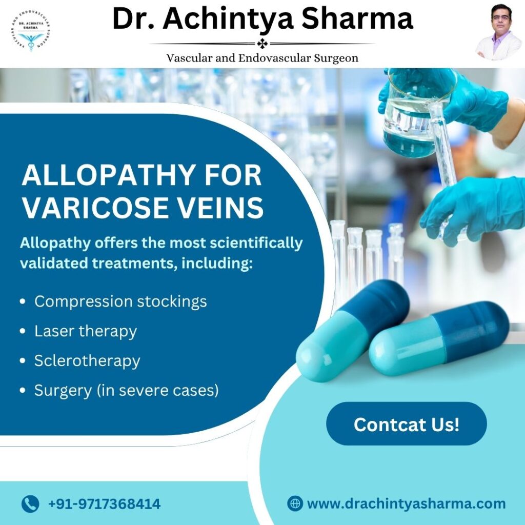 Allopathy For Varicose veins