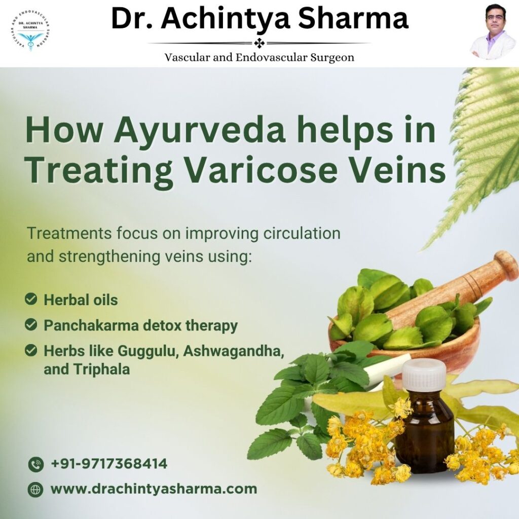 how ayurveda helps in tteating varicose veins