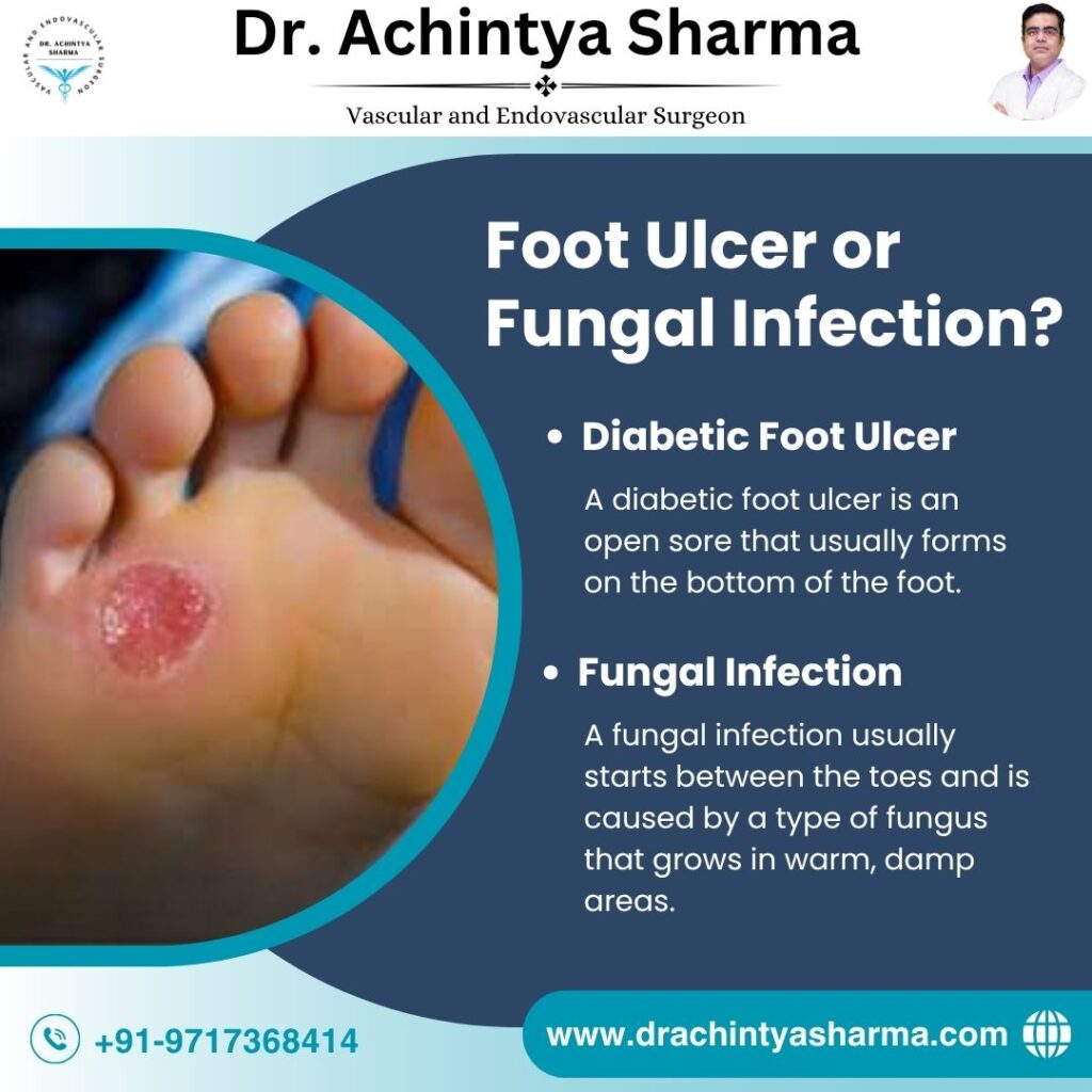 Foot Disease