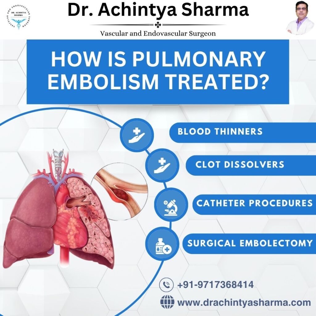 How Pulmonary Thromboembolism Treated
