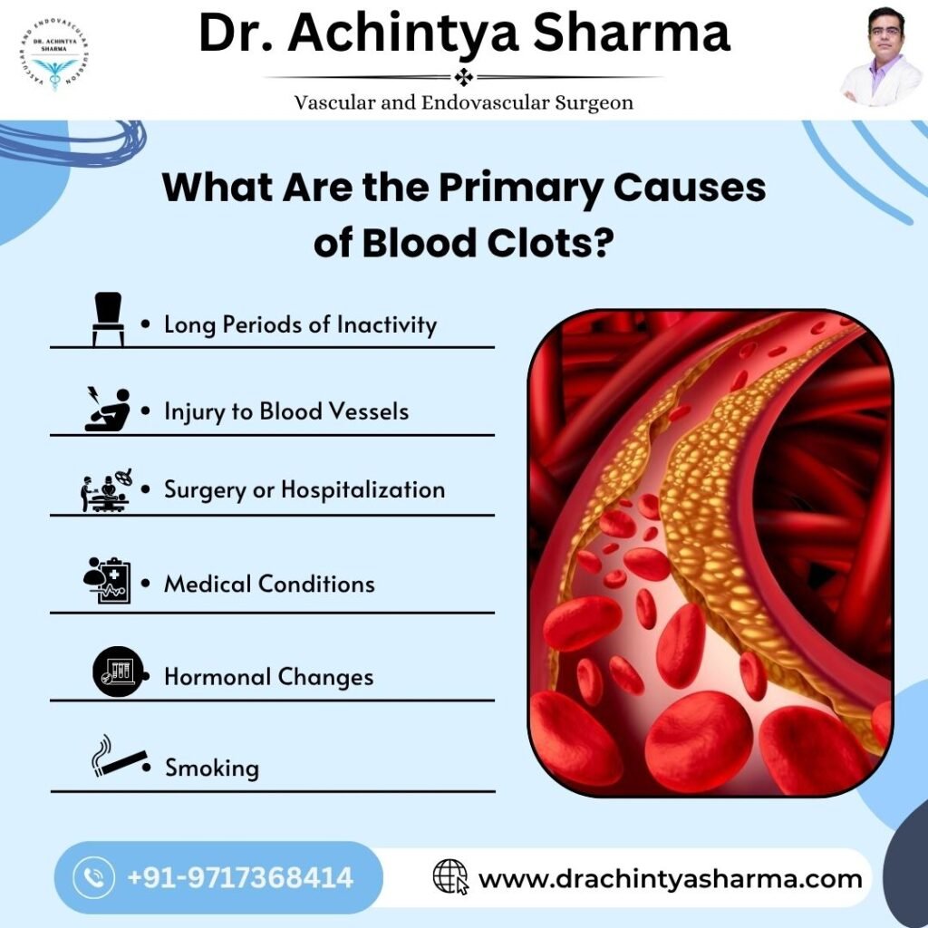 what are the primary causes of blood clots