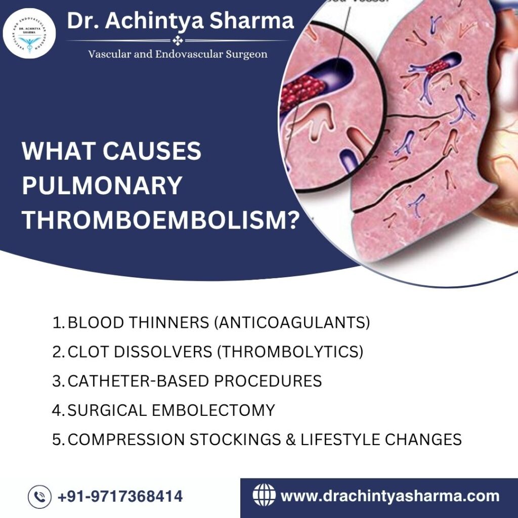 What causes Pulmonary Thromboembolism
