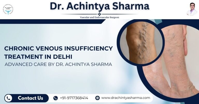 Read more about the article Chronic Venous Insufficiency Treatment in Delhi: Advanced Care by Dr. Achintya Sharma