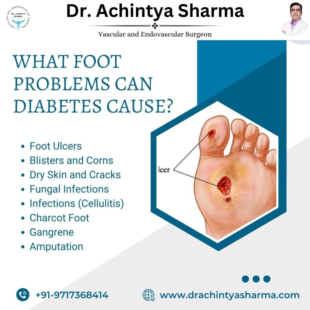 what foot problems can diabetes cause?