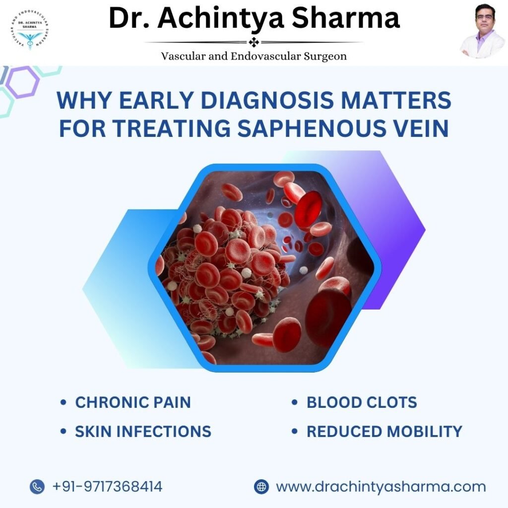 Why Early Diagnosis Matters for Treating Saphenous vein