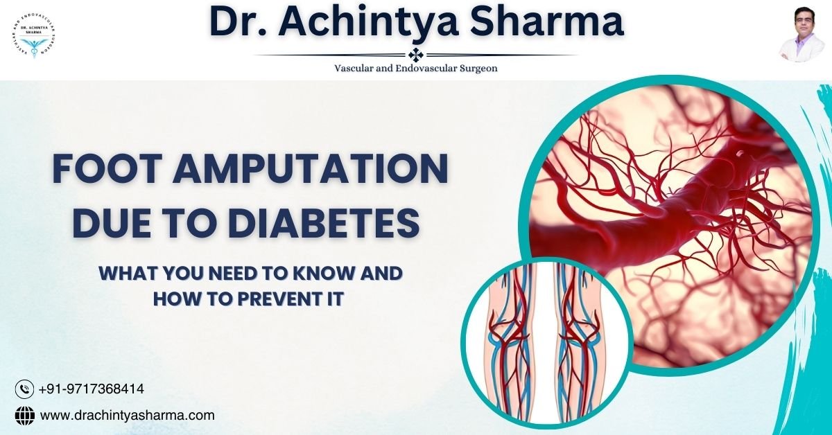 Read more about the article Understanding Thrombosis Definition and Risk Factors