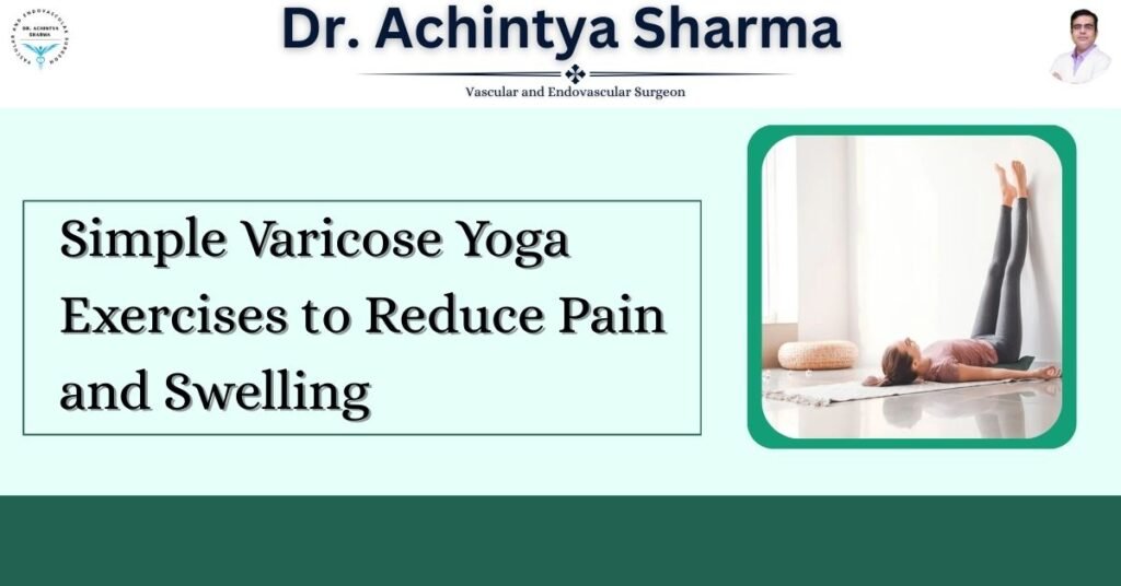 Simple Varicose Yoga Exercises to Reduce Pain and Swelling