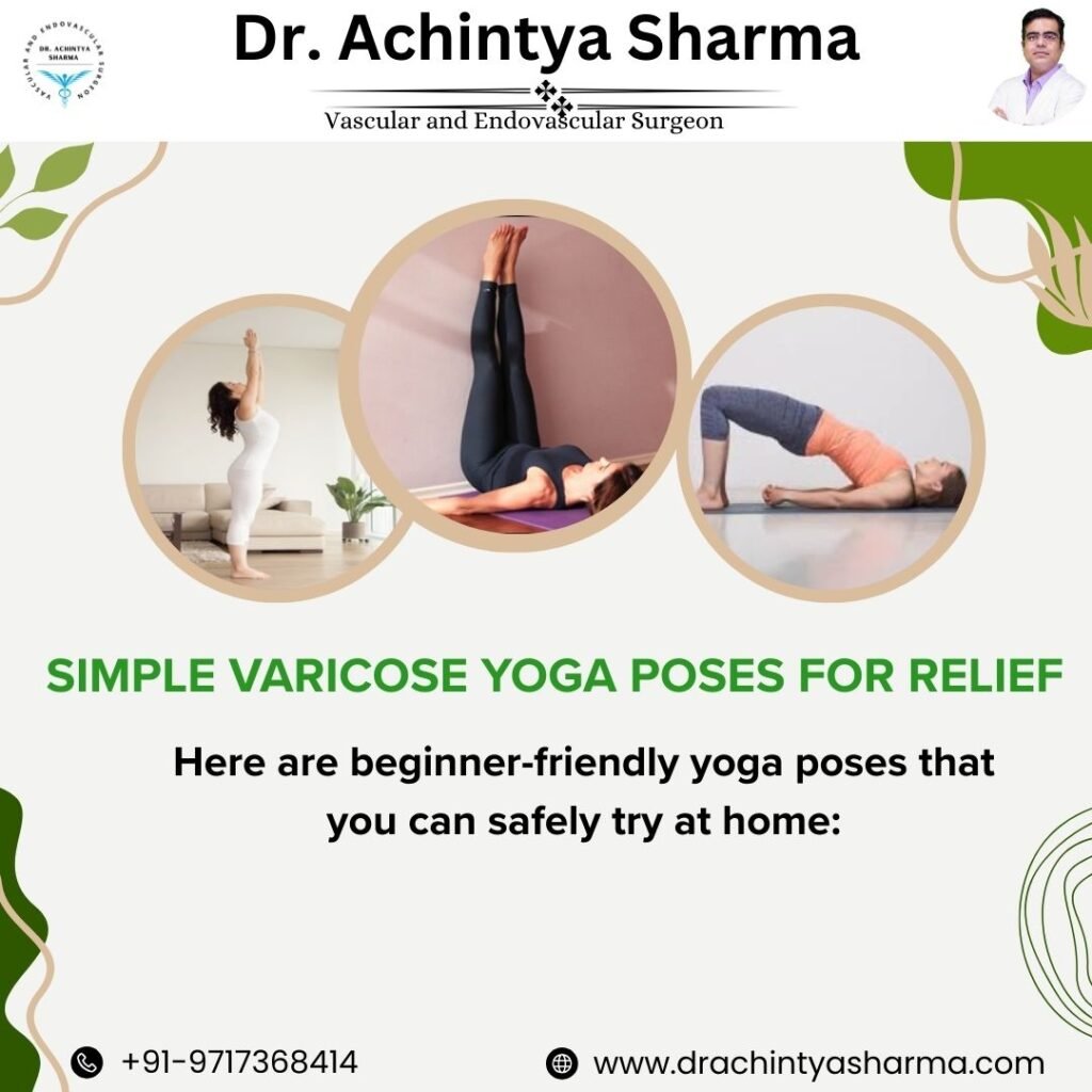 6 Simple Varicose Yoga Poses for Relief