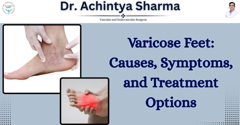 Read more about the article Varicose Feet: Causes, Symptoms, and Treatment Options