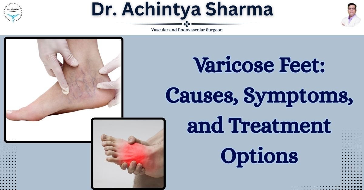 Read more about the article Varicose Feet: Causes, Symptoms, and Treatment Options