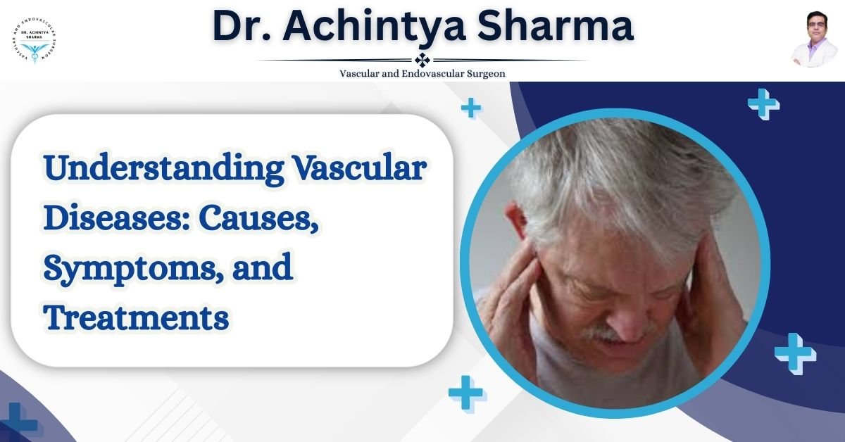 Read more about the article Understanding Vascular Diseases: Causes, Symptoms, and Treatments
