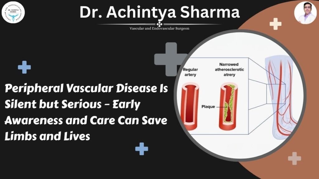 Peripheral Vascular Disease Is Silent but Serious – Early Awareness and Care Can Save Limbs and Lives