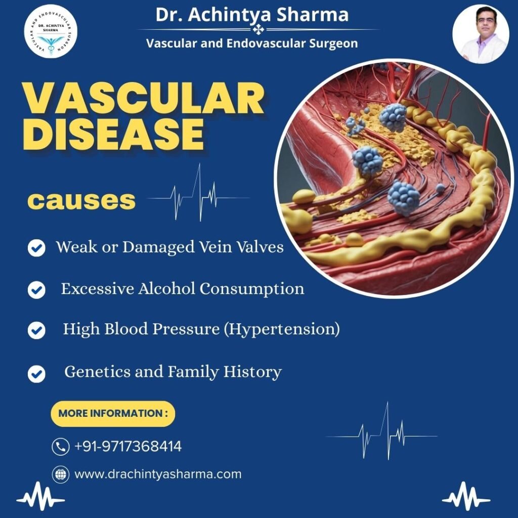Vascular Diseases
