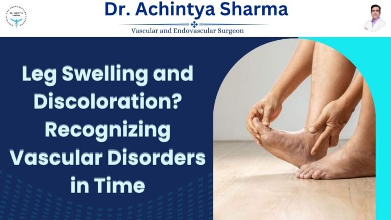 Read more about the article Leg Swelling and Discoloration? Recognizing Vascular Disorders in Time