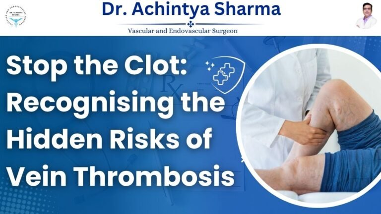 Read more about the article Stop the Clot: Recognising the Hidden Risks of Vein Thrombosis