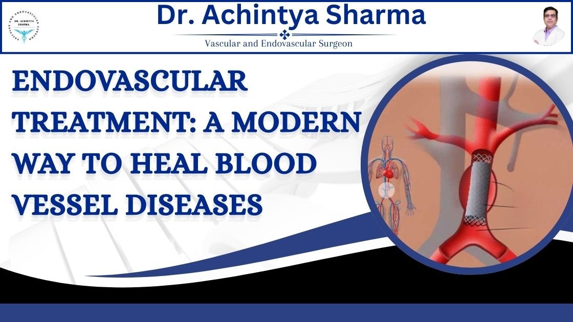 Read more about the article Endovascular Treatment: A Modern Way to Heal Blood Vessel Diseases