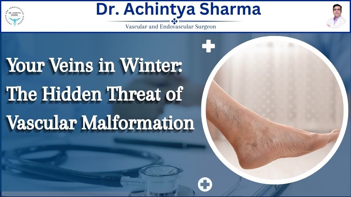 Read more about the article Your Veins in Winter: The Hidden Threat of Vascular Malformations