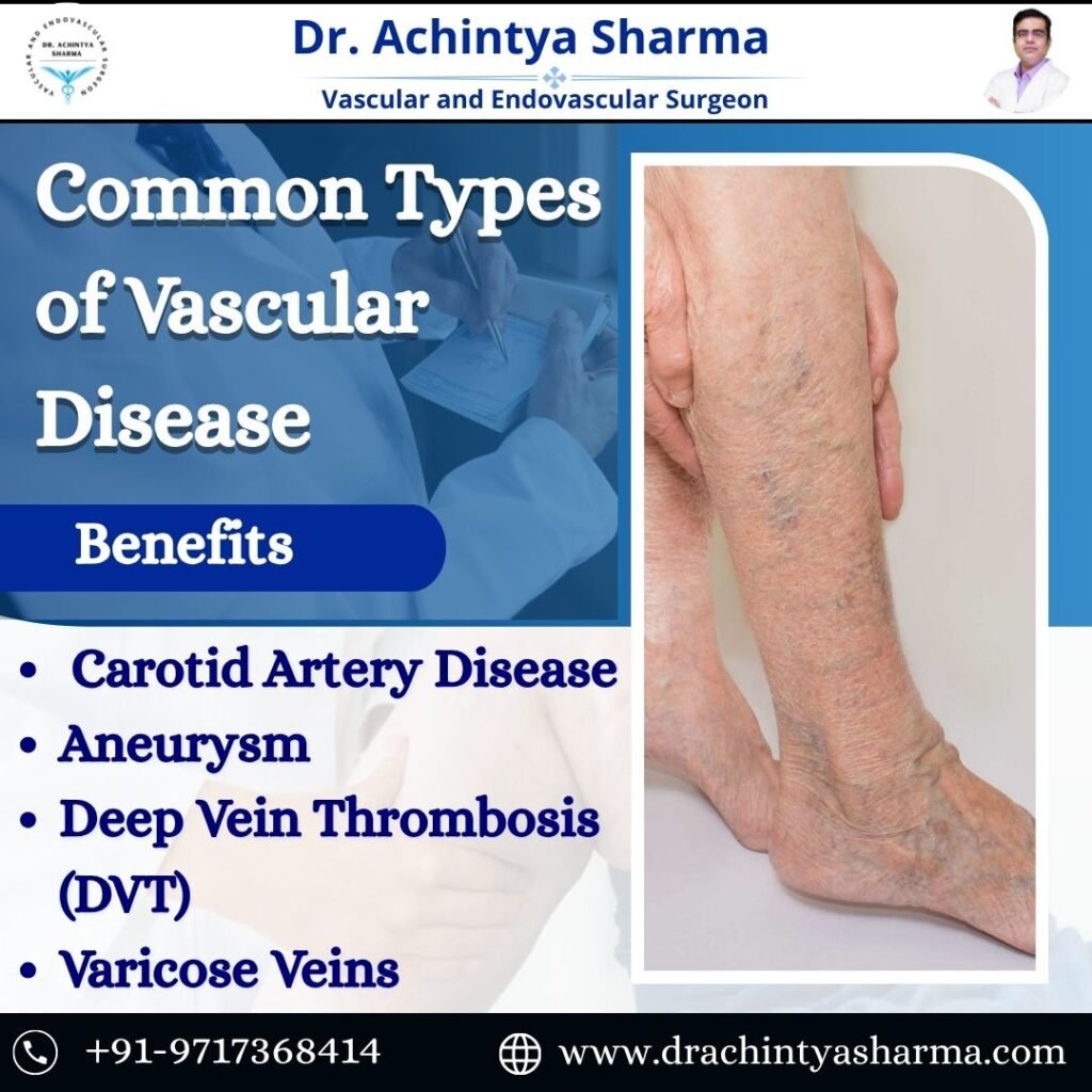 common type of vascular disease 