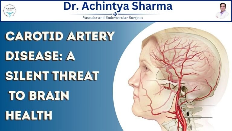 Read more about the article Carotid Artery Disease: A Silent Threat to Brain Health