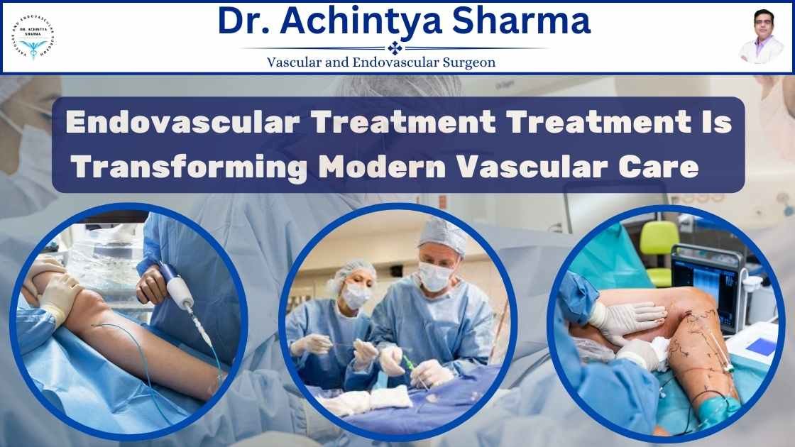 Read more about the article How Endovascular Treatment Is Transforming Modern Vascular Care