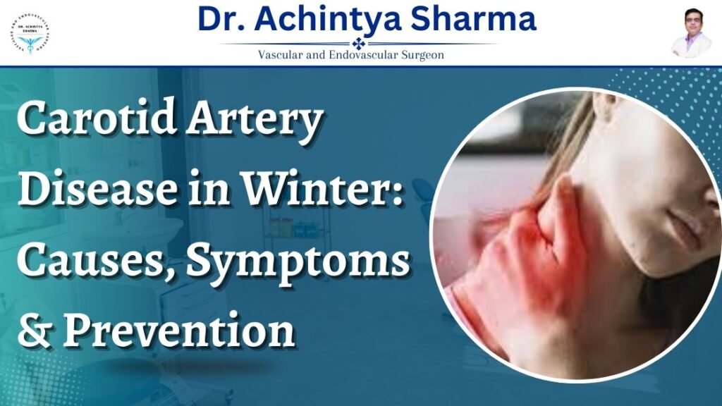 Carotid Artery Disease in Winter
