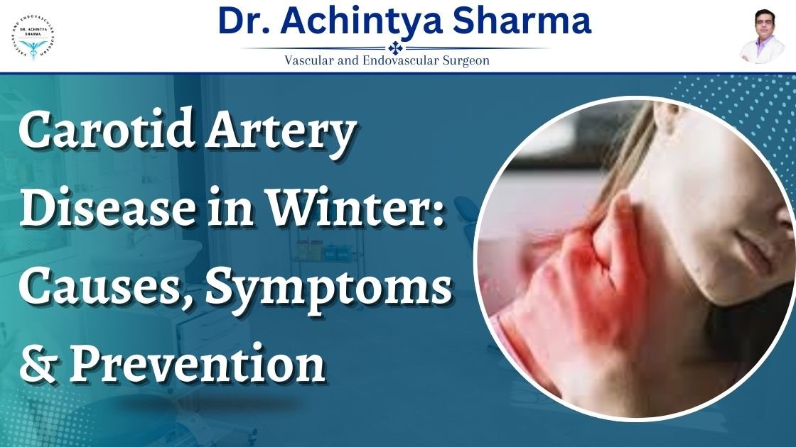 Read more about the article Carotid Artery Disease in Winter: Causes, Symptoms & Prevention