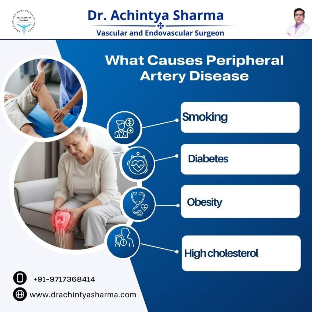 what cause peripherial artery disease