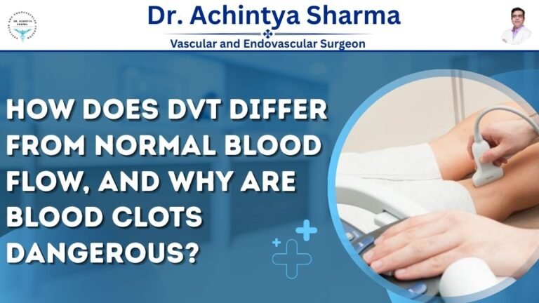 Read more about the article How Does Dvt Differ From Normal Blood Flow, and Why Are Blood Clots Dangerous