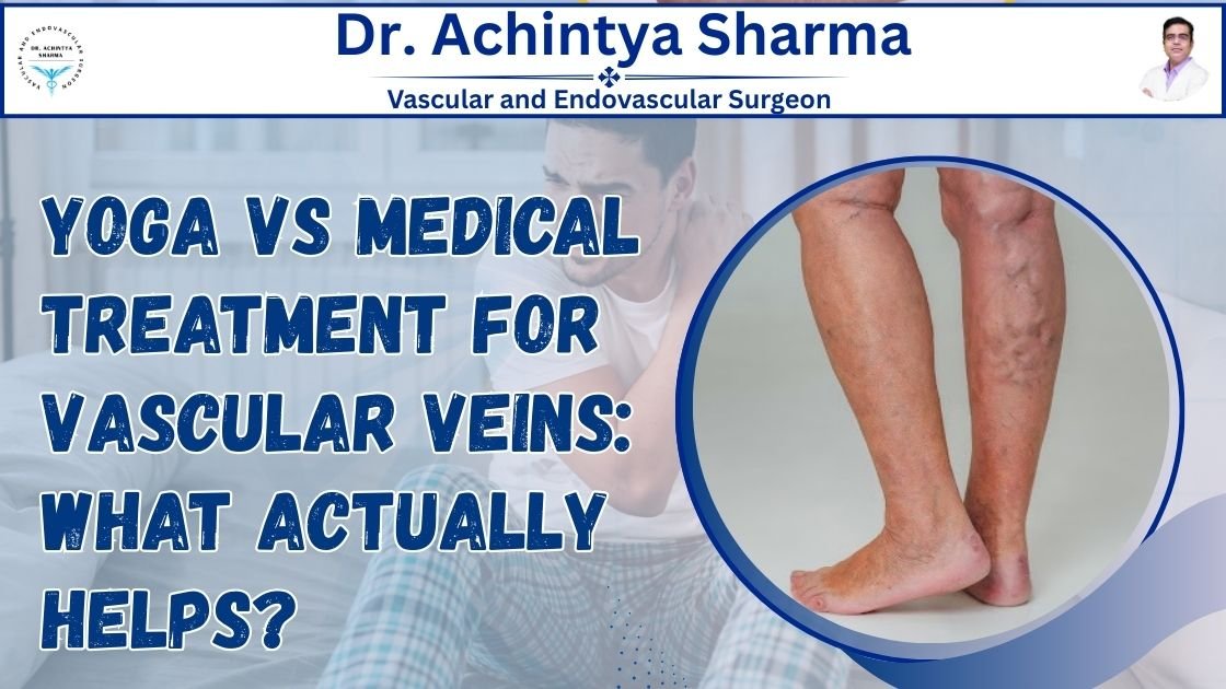 You are currently viewing Yoga vs Medical Treatment for Vascular Veins: What Actually Helps?