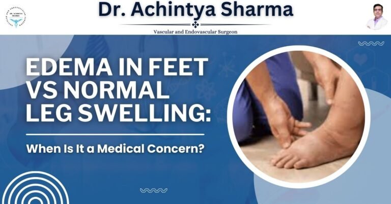 Read more about the article Edema in Feet vs Normal Leg Swelling: When Is It a Medical Concern?