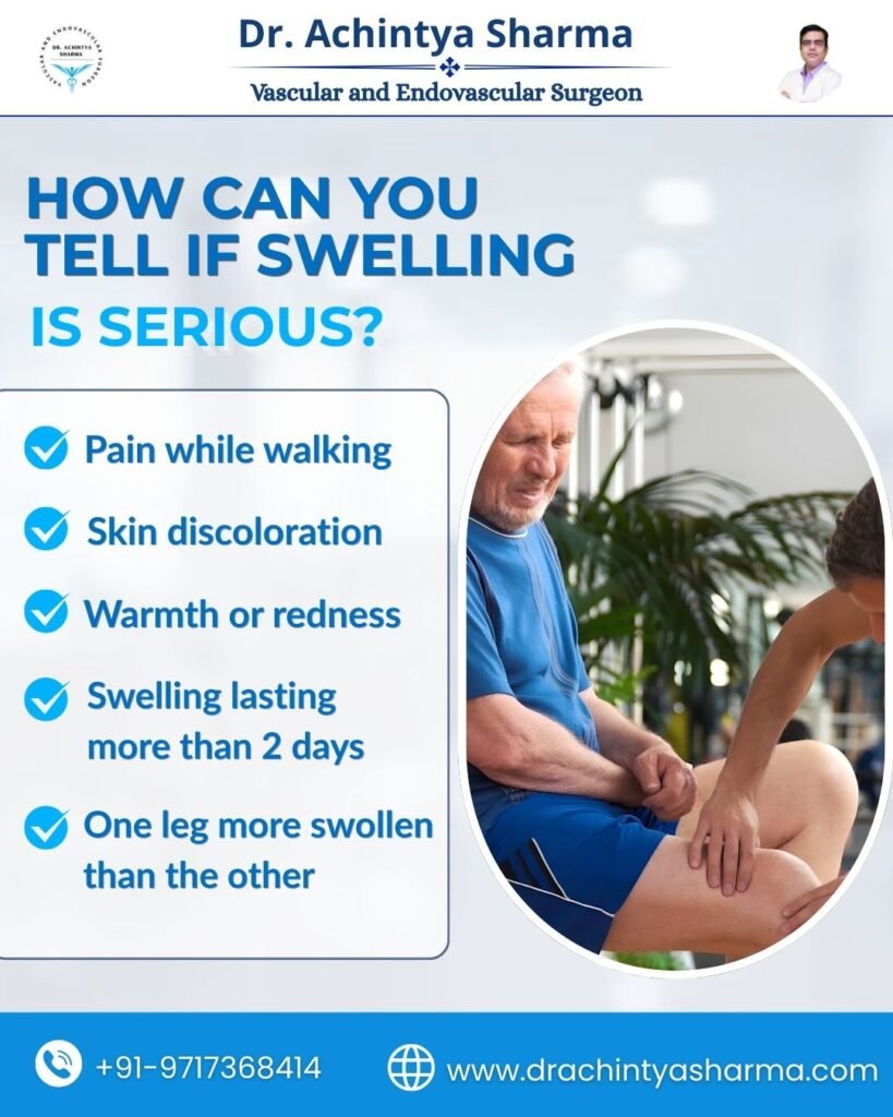 How can you tell if swelling is serious?